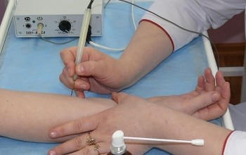 Удаление бородавок сургитроном