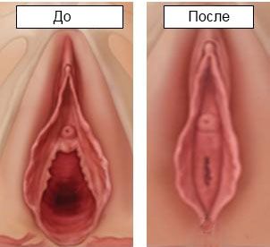 Как Выглядит Влагалище Фото Как Выглядит Влагалище Фото