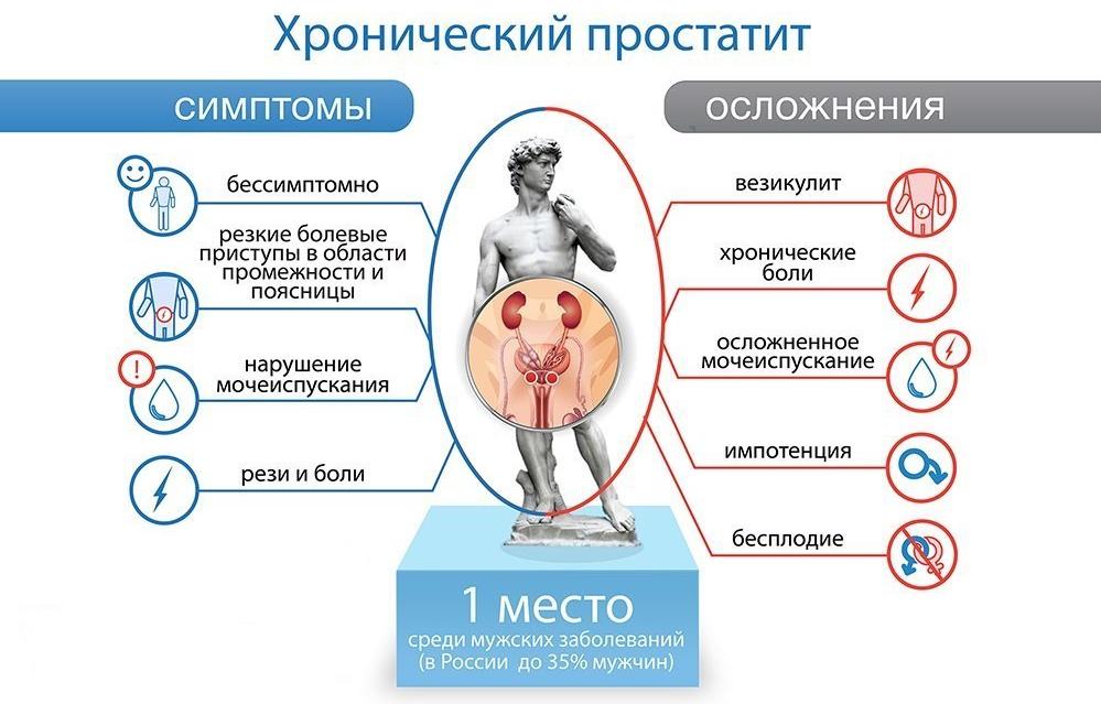 Запись на прием к андрологу при симптомах простатита