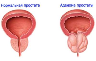 Сравнительное - фото